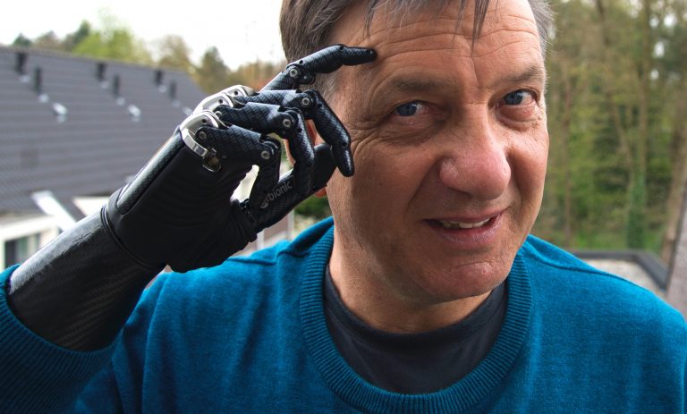 “In Switzerland, it is now legal to replace a limb with a robotic prosthetic – and do that as elective surgery,” said Rev Dr Pete Philips, Director at Durham University’s Centre for Digital Theology. Photo by Henk Mul on Unsplash