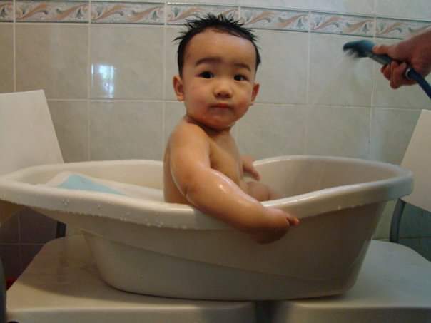 The Yuens suspected something was not right when baby Josiah kept missing his developmental milestones.