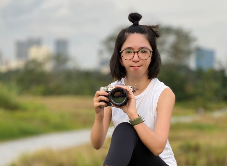 Isabelle Lim was born with Nager syndrome that left her with facial and limb deformities. She is also profoundly deaf. But she has overcome it all to become a professional photographer. All photos courtesy of Isabelle Lim.